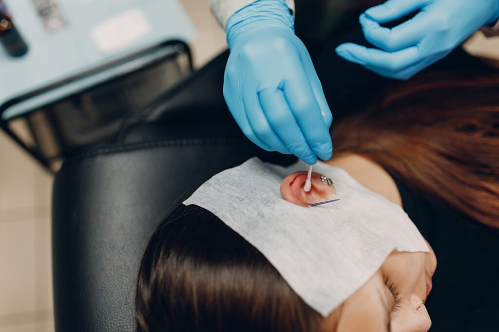 Persona aplicando los cuidados para piercing correctos en su oreja, usando una gasa con solución salina.